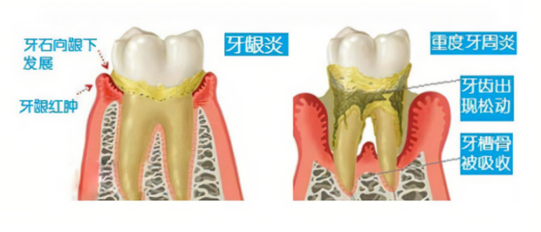 662f525ed39ba064e96acb578cf403f6.png
