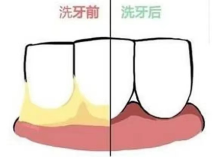 6114e05d126610c144557fc298d55dff.png