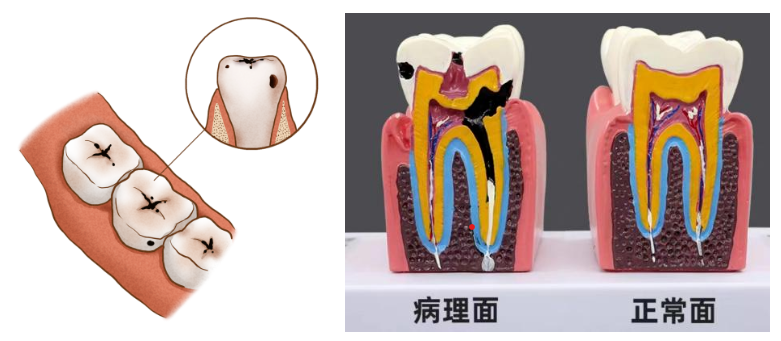 小小的黑点，大大的危害