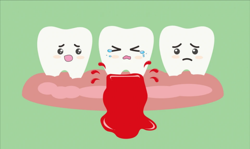 可怕的牙龈出血，居然是因为我刷牙“摸鱼”!