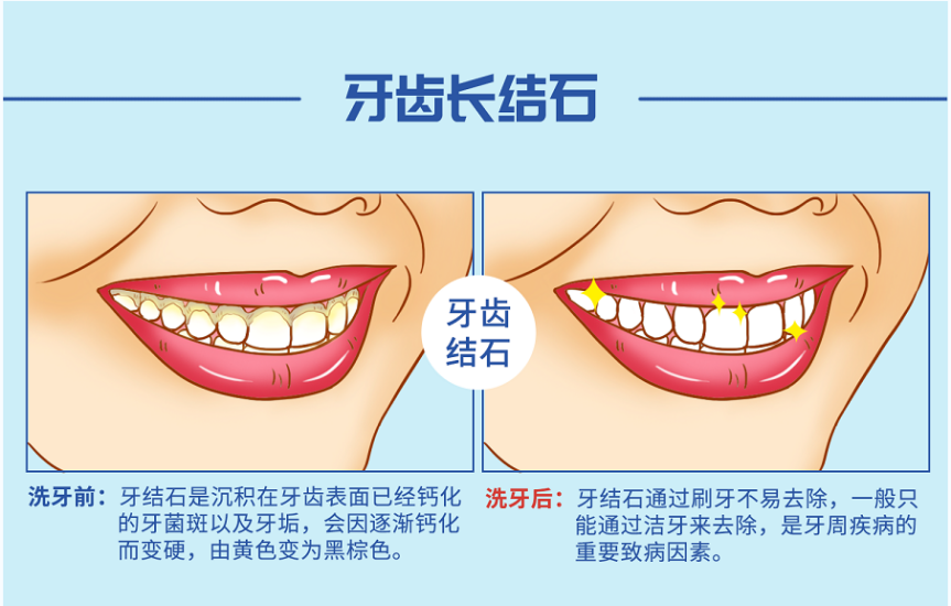 ec13a747e4d0568d91fe7d9cde04296a.png