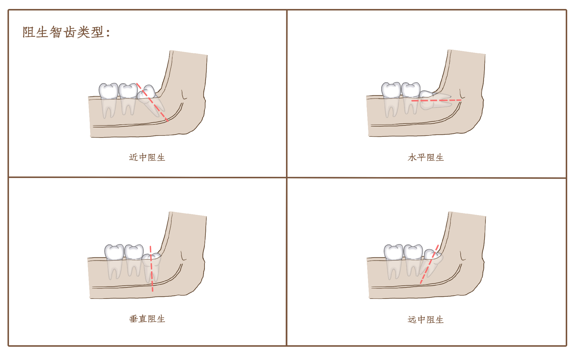 ed3a620e2f34f3785ddbd860c18b3a49.png