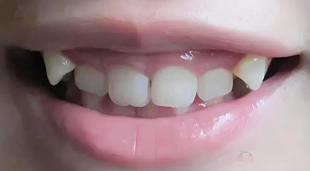 ab525c3d3fd1fdc8aeb8cbe9b1f0b0b0.jpg