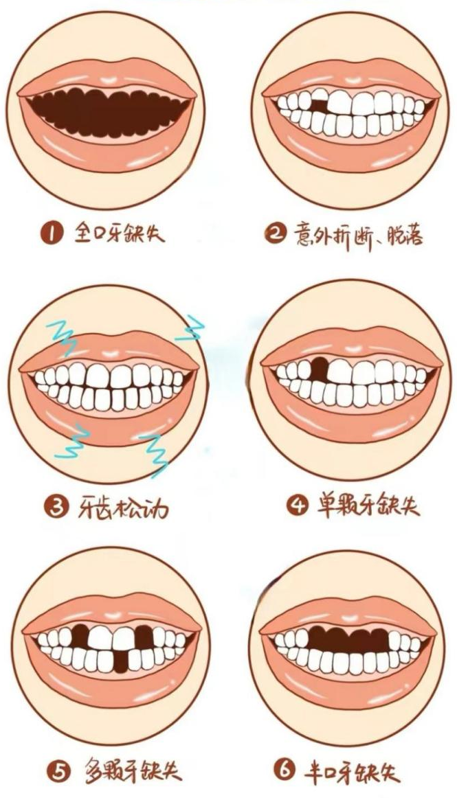 57243dad368083cd442fa7dcaf172b68.png