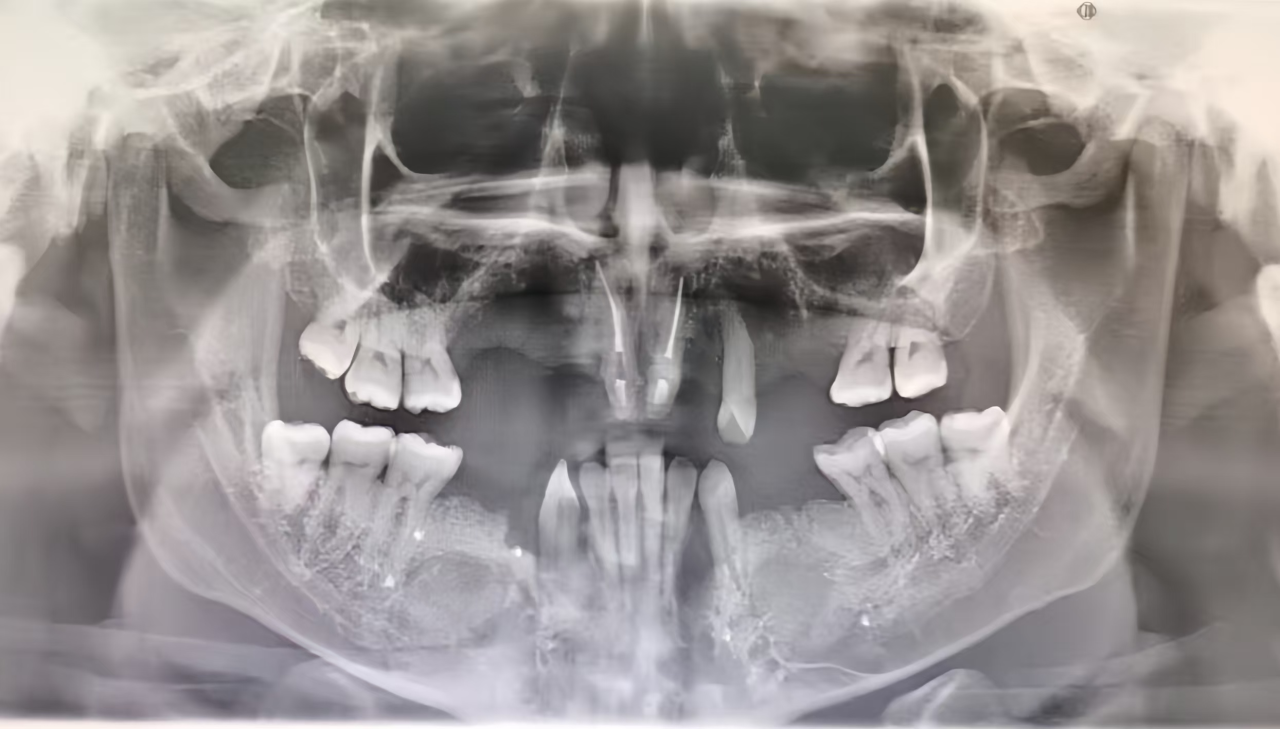 eb9d4494b600d18ccd3c091bc4256bf6.png
