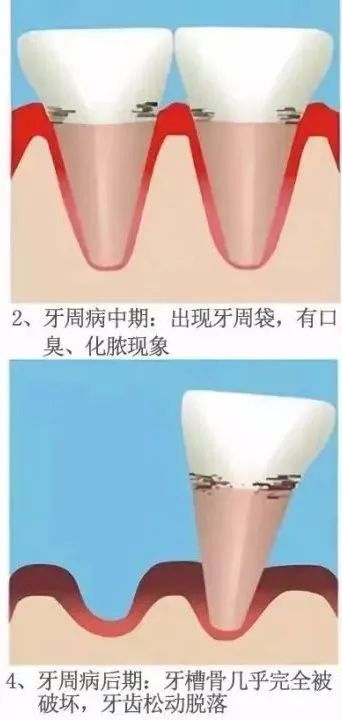 dd920fba00e51cc433a8674e1efef800.jpg